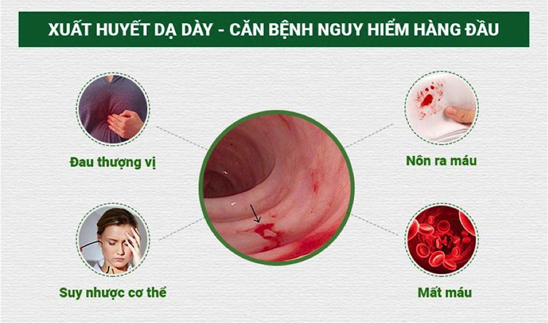 Viêm dạ dày cấp tính