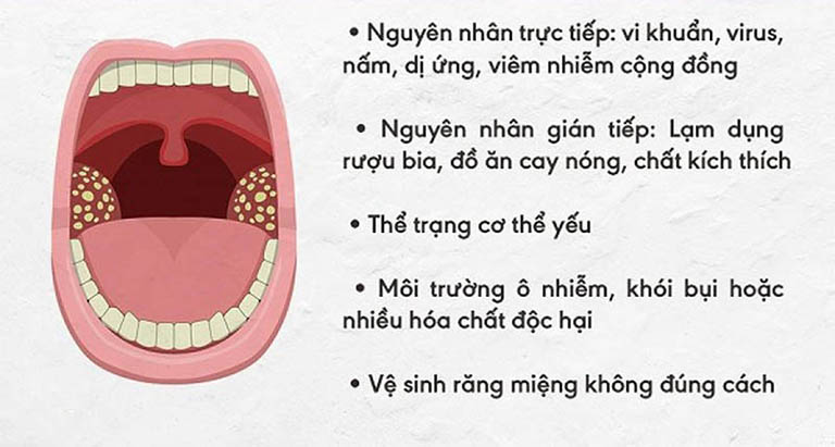 Viêm họng hạt có mủ