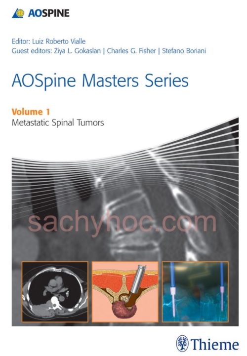 [Bộ 10 tập] AOSpine Masters Series – Tập 1. Các khối u cột sống di căn