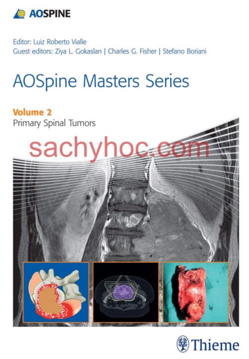 [Bộ 10 tập] AOSpine Masters Series – Tập 2. Khối u cột sống nguyên phát