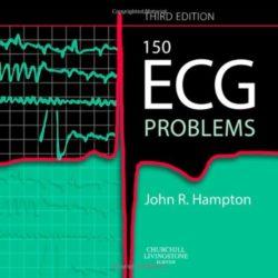 150 vấn đề điện tâm đồ (Sách dịch) – John R.Hampton