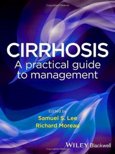 Cirrhosis: A Practical Guide to Management