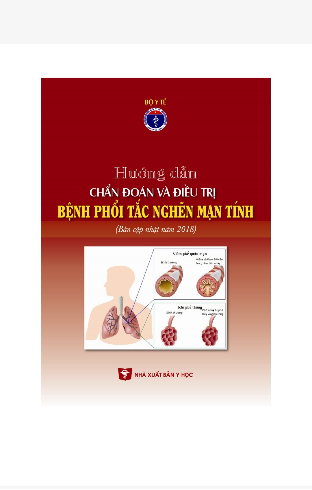 [Tài Liệu] Hướng Dẫn Chẩn Đoán Và Điều Trị: Bệnh Phổi Tắc Nghẽn Mạn Tính – Bộ Y Tế