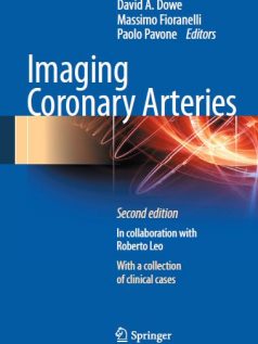 Imaging Coronary Arteries 2nd
