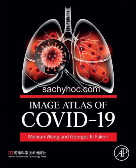Atlas chẩn đoán hình ảnh Covid-19, ấn bản 2022