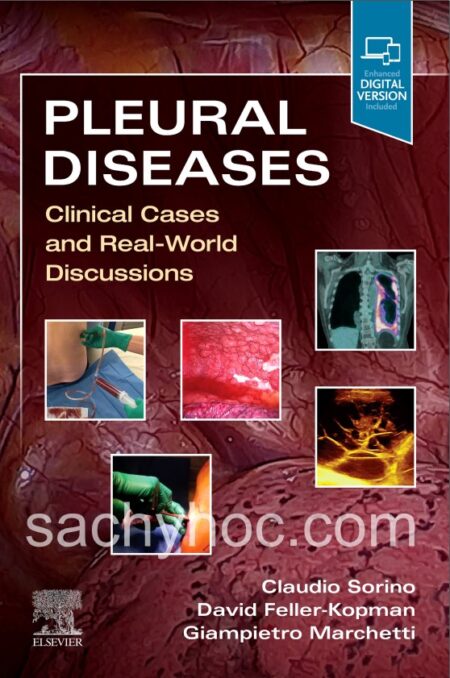 Bệnh màng phổi: Các trường hợp lâm sàng và thảo luận thế giới thực, ấn bản 2021