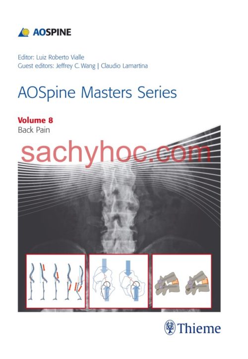 [Bộ 10 tập] AOSpine Masters Series – Tập 8. Đau lưng