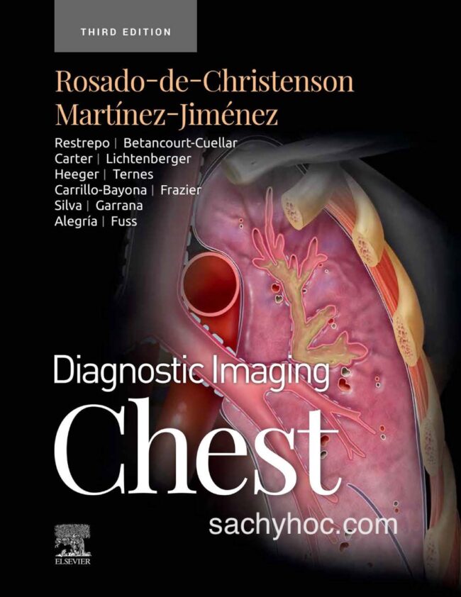 Chẩn đoán hình ảnh Lồng ngực, ấn bản 3, 2022