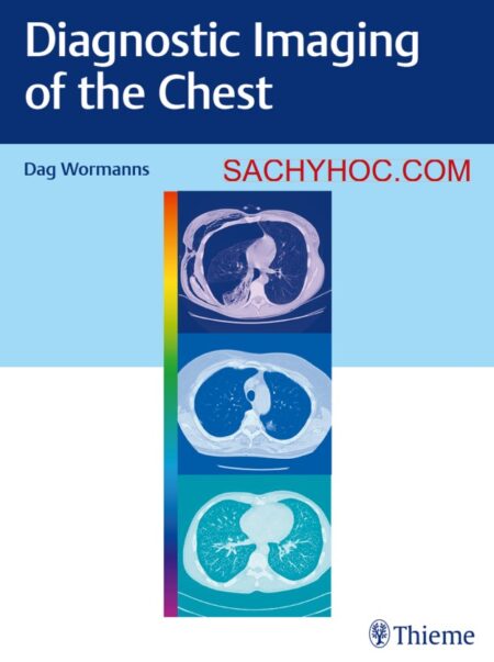 Chẩn đoán hình ảnh lồng ngực của Wormanns, ấn bản 2020
