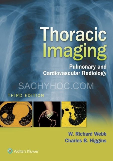 Chẩn đoán hình ảnh lồng ngực: X quang phổi và tim mạch, Phiên bản 3
