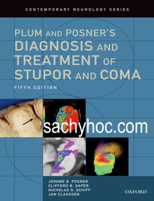 Chẩn đoán và Điều trị suy giảm ý thức và Hôn mê của Plum và Posner – ấn bản thứ 5