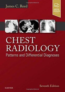 X quang phổi: Các mô hình và chẩn đoán phân biệt, 7e, Jame Reed