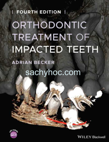 Điều trị chỉnh nha cho răng bị ảnh hưởng, ấn bản 2022