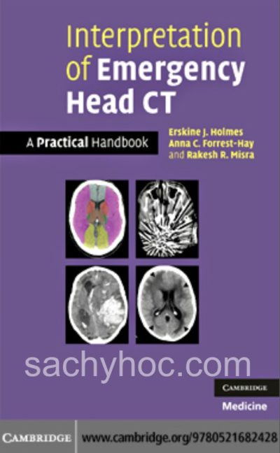 Giải thích CT sọ não cấp cứu: Cẩm nang thực tế
