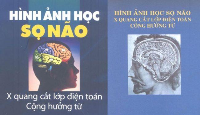 Hình ảnh học sọ não (CT-MRI), Jacques Clarisse, Nguyễn Thi Hùng, Phạm Ngọc Hoa