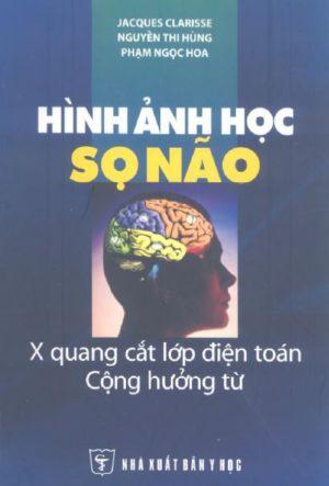 Hình Ảnh Học Sọ Não – X Quang/CT/MRI