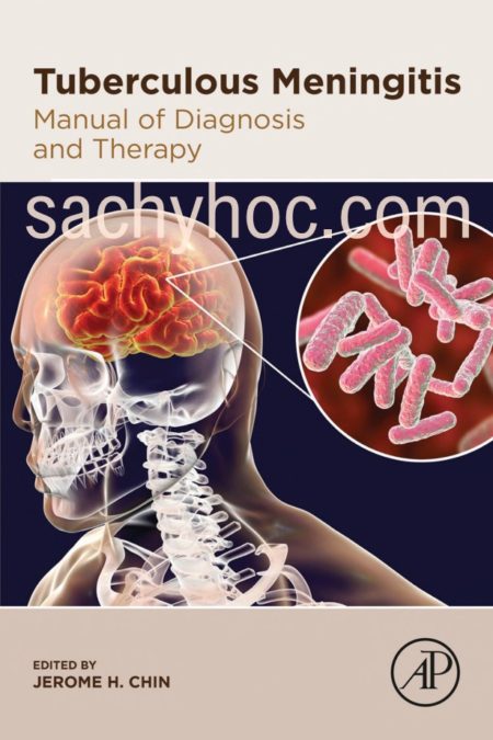 Lao màng não: Cẩm nang chẩn đoán và điều trị, ấn bản 2020