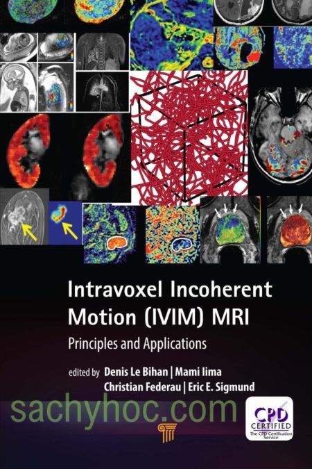 MRI Chuyển động nội voxel không liên tục (IVIM) – Nguyên lý và ứng dụng lâm sàng, 2019