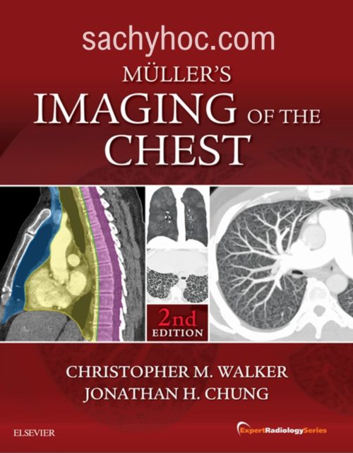 Muller Chẩn đoán hình ảnh lồng ngực, Phiên bản 2
