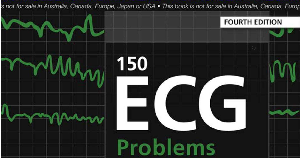 [PDF] 150 ECG Problems – John R. Hampton