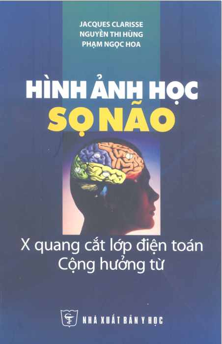 [PDF] HÌNH ẢNH HỌC SỌ NÃO