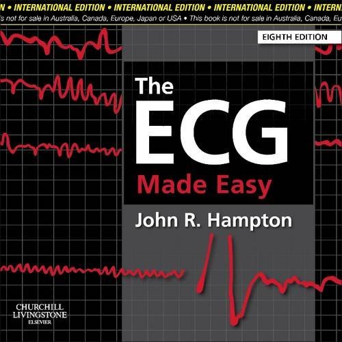 [PDF] The ECG Made Easy 8th Edition – John R. Hampton