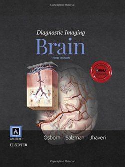 [Series] Chẩn đoán hình ảnh: Não, Phiên bản 3