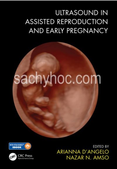 Siêu âm trong hỗ trợ sinh sản và mang thai sớm – ấn bản 2020