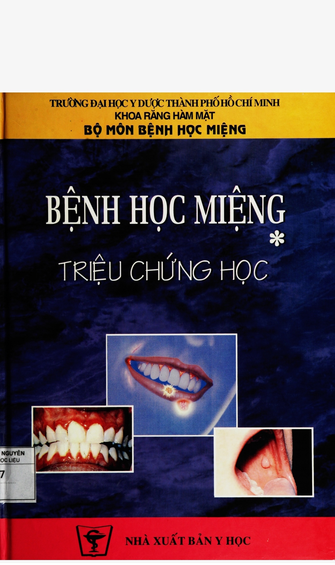 [Tài Liệu] Bệnh Học Miệng: Triệu Chứng Học – Đại Học Y Dược  TPHCM