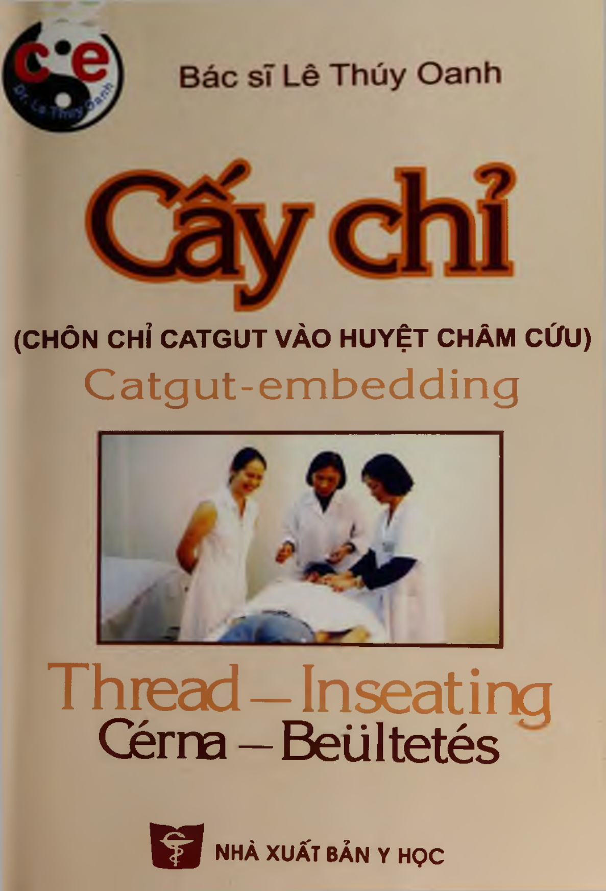 [Tài Liệu] Cấy Chỉ (Chôn Chỉ Catgut Vào Huyệt Châm Cứu)