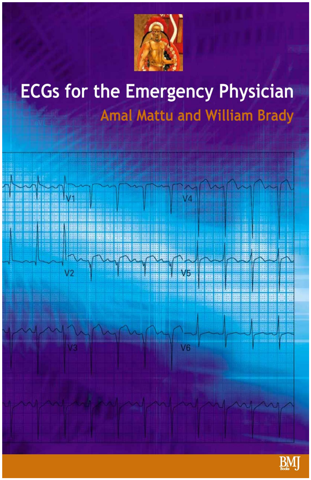 [Tài Liệu Dịch] ECGs Cho Bác Sĩ Cấp Cứu – ECGs For The Emergency Physician