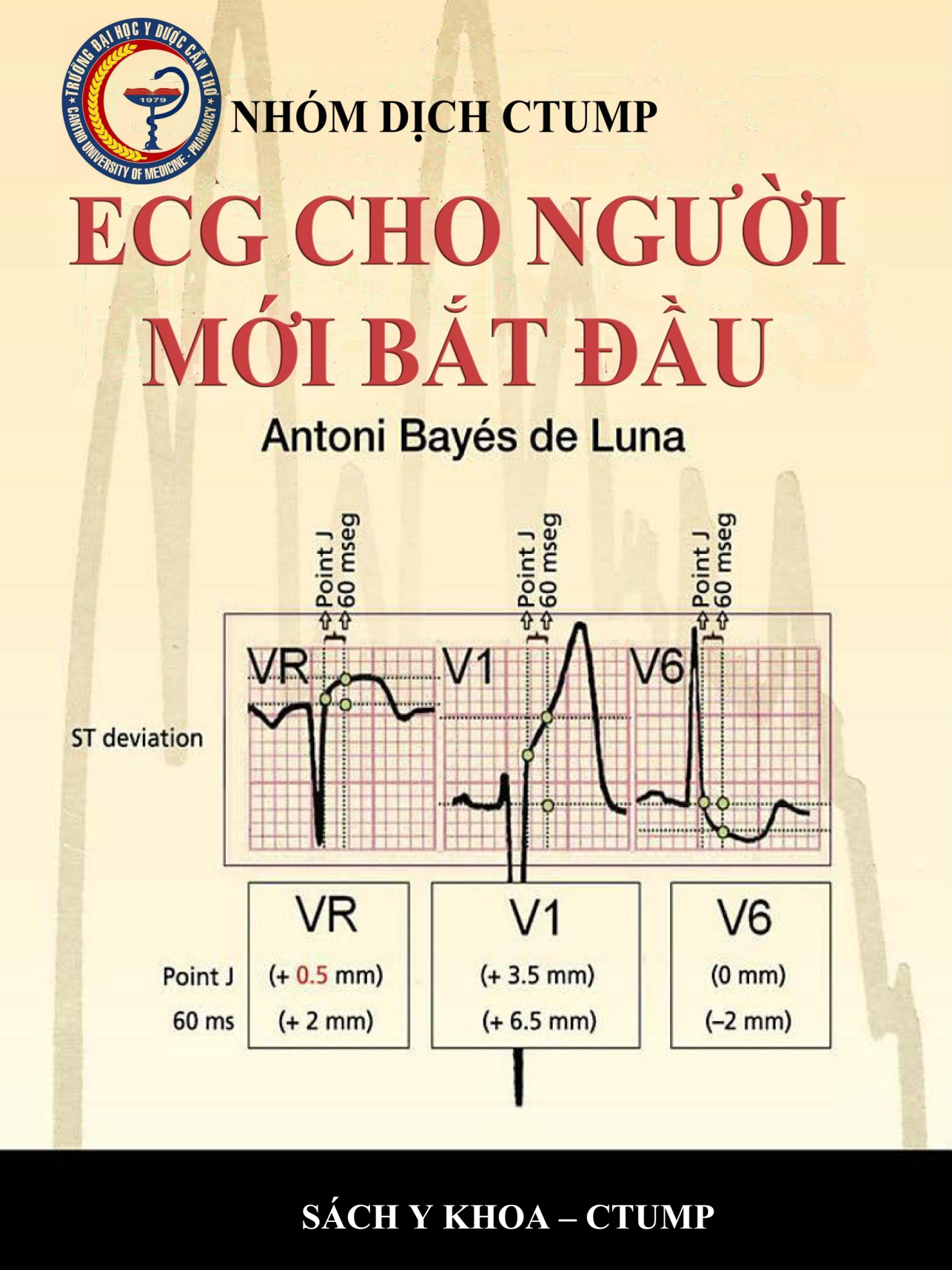 [Tài Liệu Dịch] ECGs Cho Người Mới Bắt Đầu – ECGs For Beginners