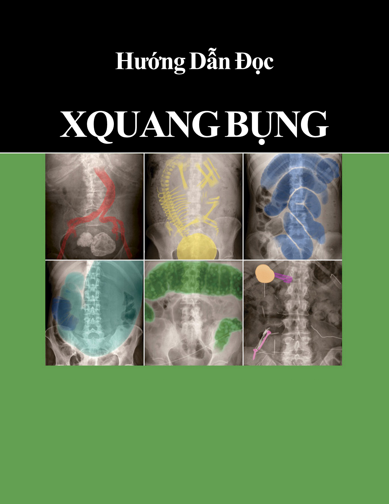 [Tài Liệu Dịch] Hướng Dẫn Đọc X-Quang Bụng – Bản FULL