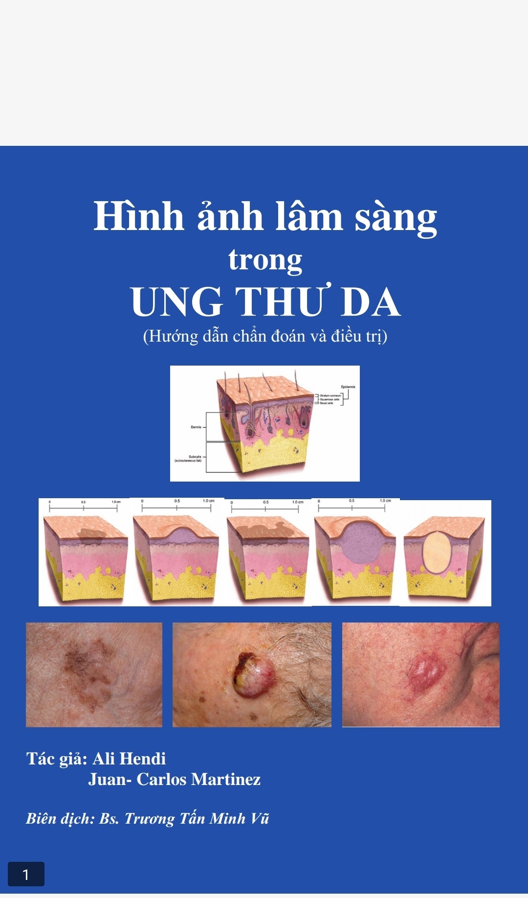 [Tài Liệu] Hình Ảnh Lâm Sàng Trong Ung Thư Da – BS. Trương Tấn Minh Vũ